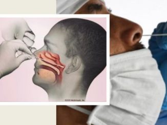 Nasal cavity swab