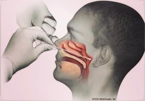 Nasal cavity swabs